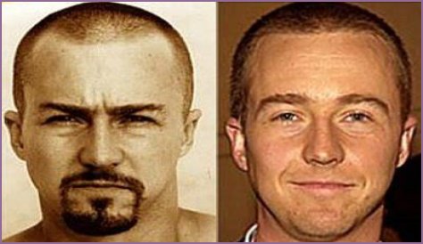 Edward Norton Plastic Surgery Before and After
